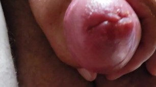 More swollen cock and balls